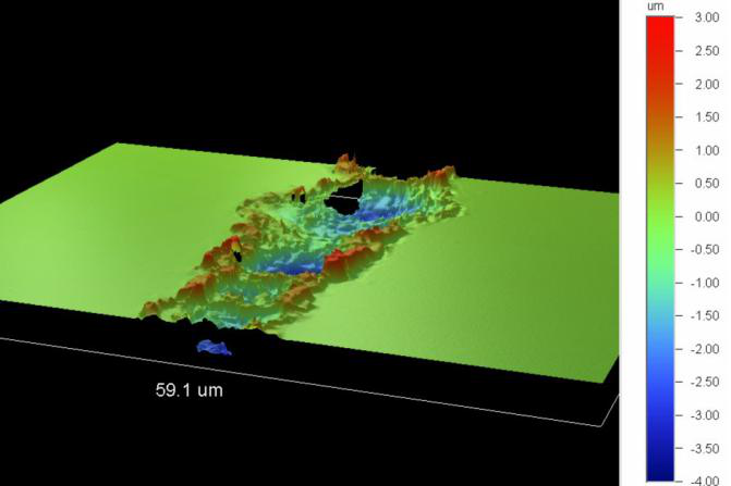 PERFURAÇÃO DE MICROVIA A LASER (4)