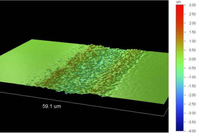 PERFURAÇÃO DO MICROVIA A LASER (8)