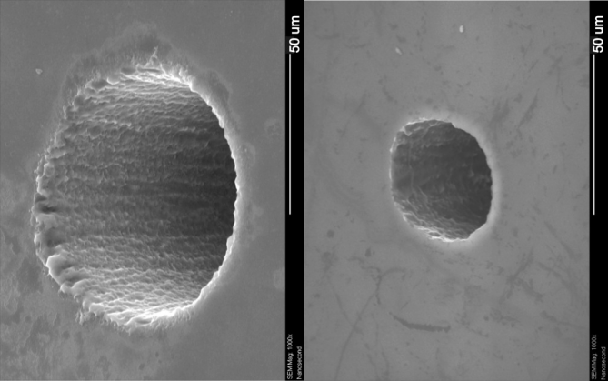 PERFURAÇÃO DO MICROVIA A LASER (9)