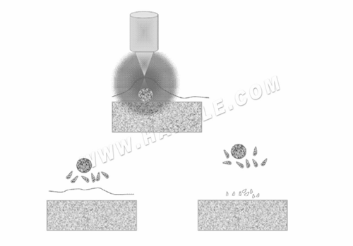 Máquina de Descalcimento a laser