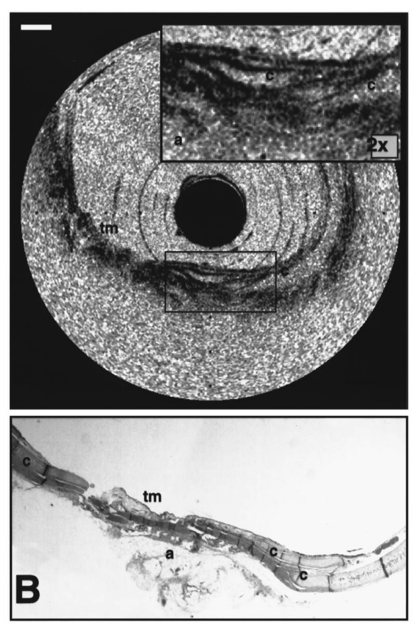 Tecnologia de laser (3)