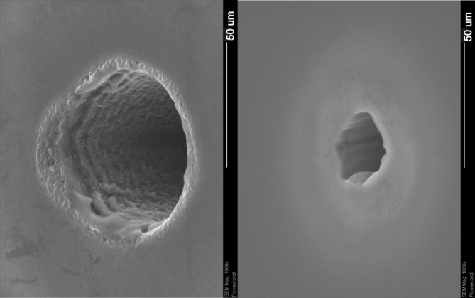 PERFURAÇÃO DO MICROVIA A LASER (10)