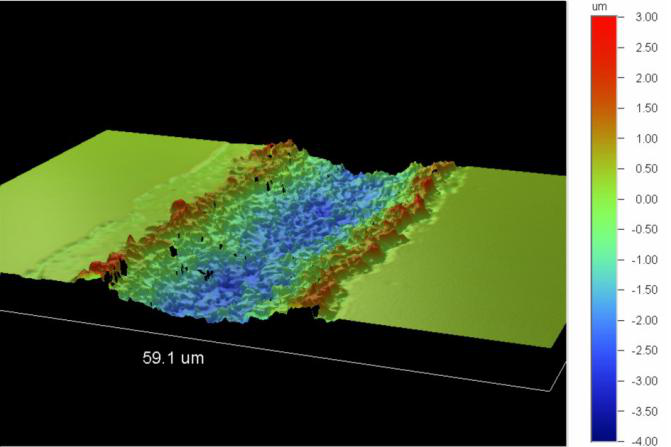 PERFURAÇÃO DE MICROVIA A LASER (3)