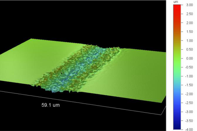 PERFURAÇÃO DE MICROVIA A LASER (7)