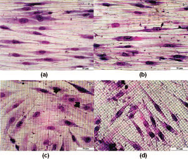 Aplicações de Laser (5)